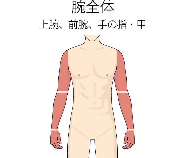 腕全体