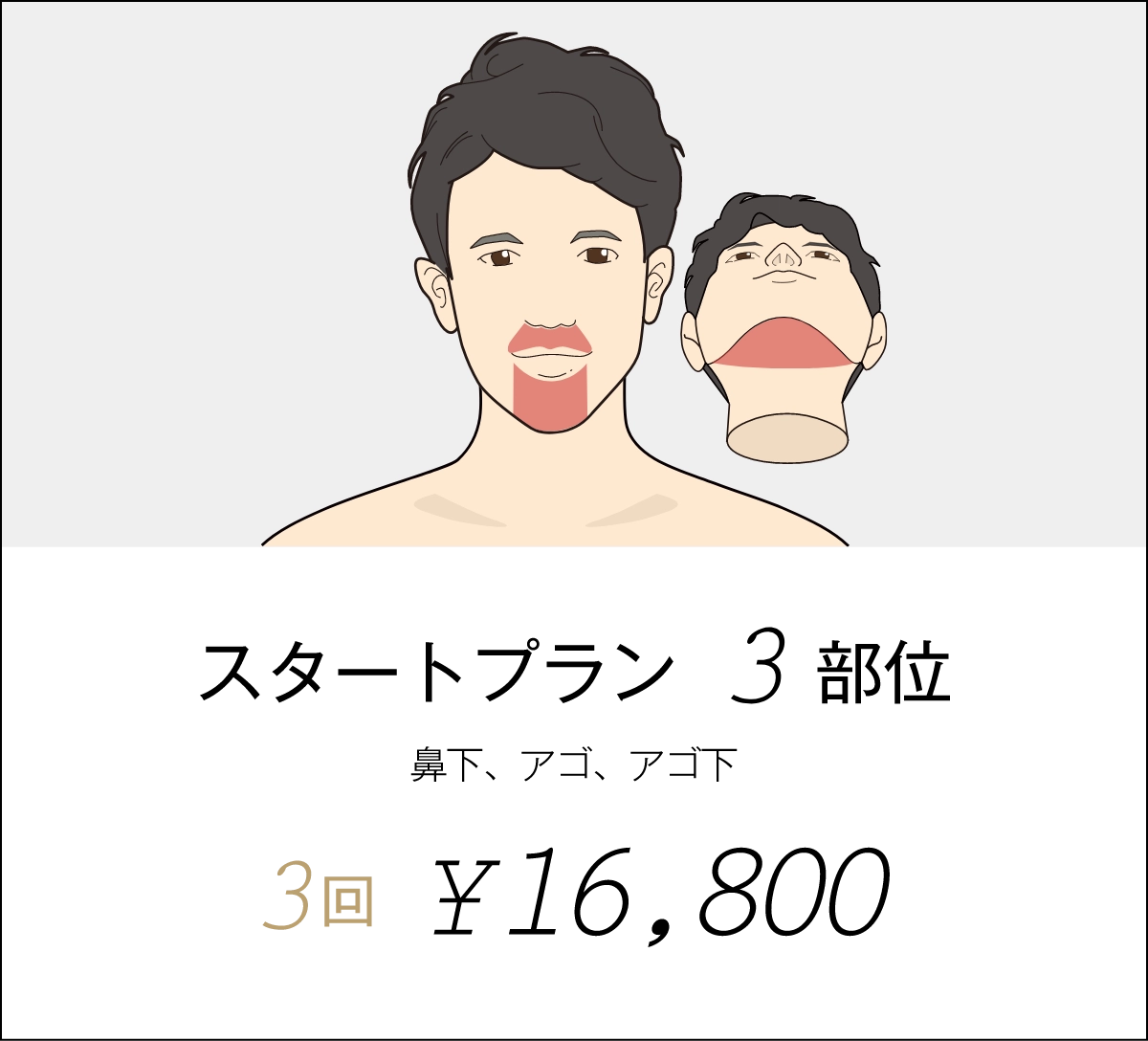 スタートプラン