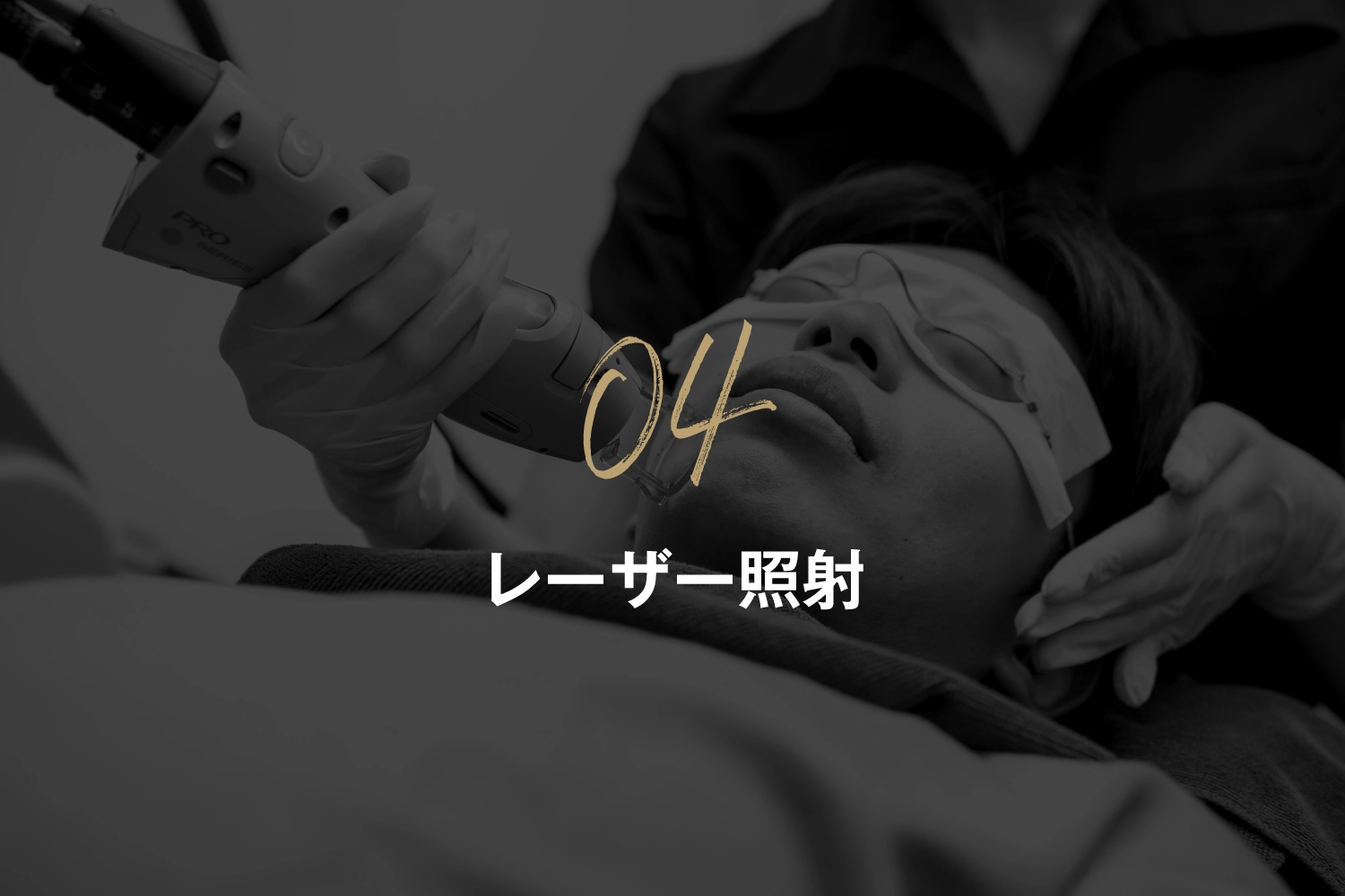 レーザー照射