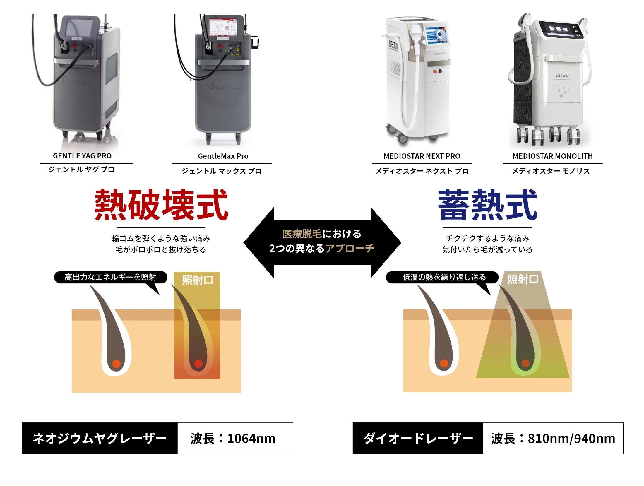 熱破壊式脱毛機と蓄熱式脱毛機の違い