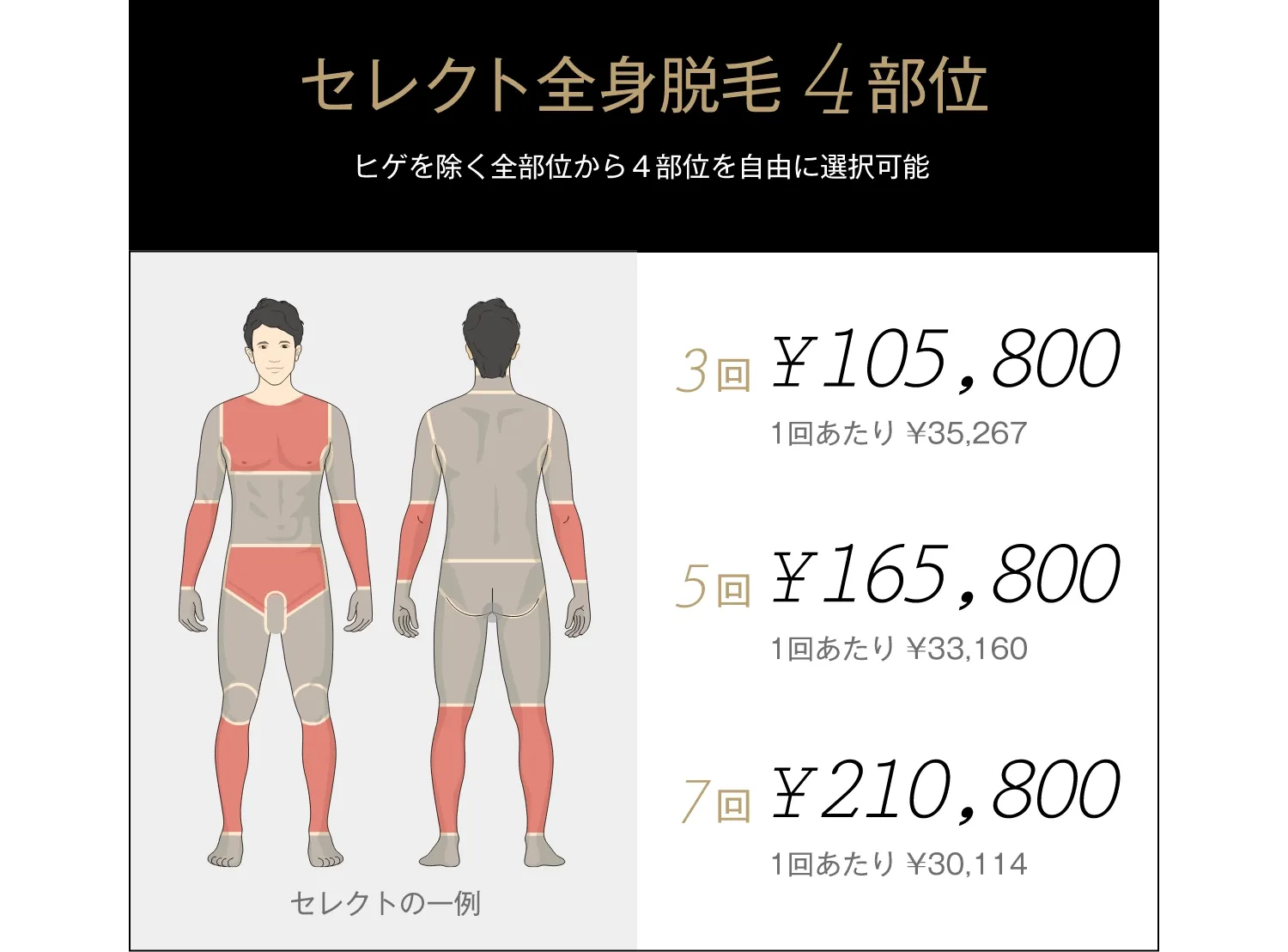 セレクト全身脱毛4部位
