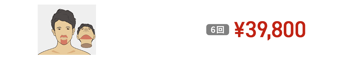 ヒゲ脱毛３部位