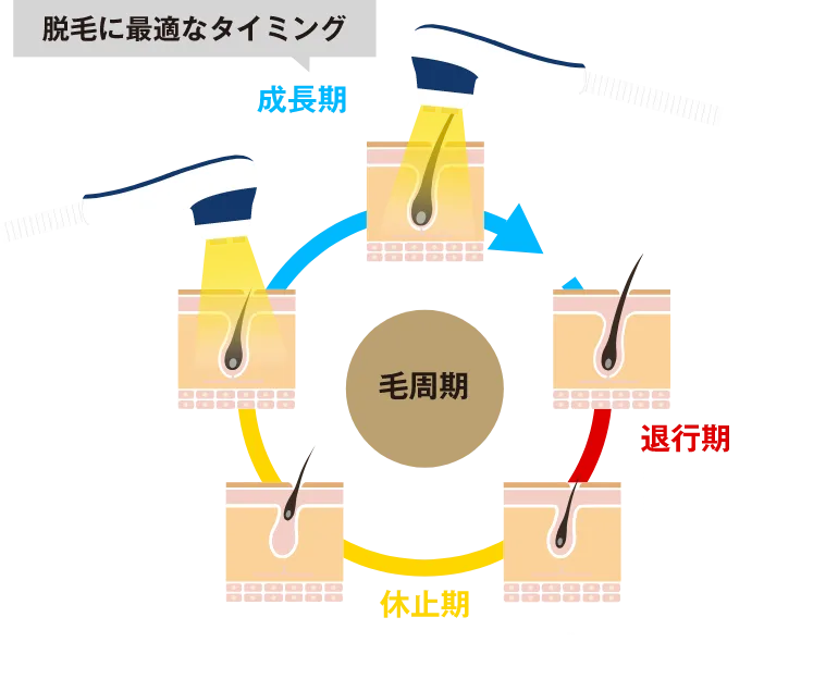 脱毛に最適なタイミング