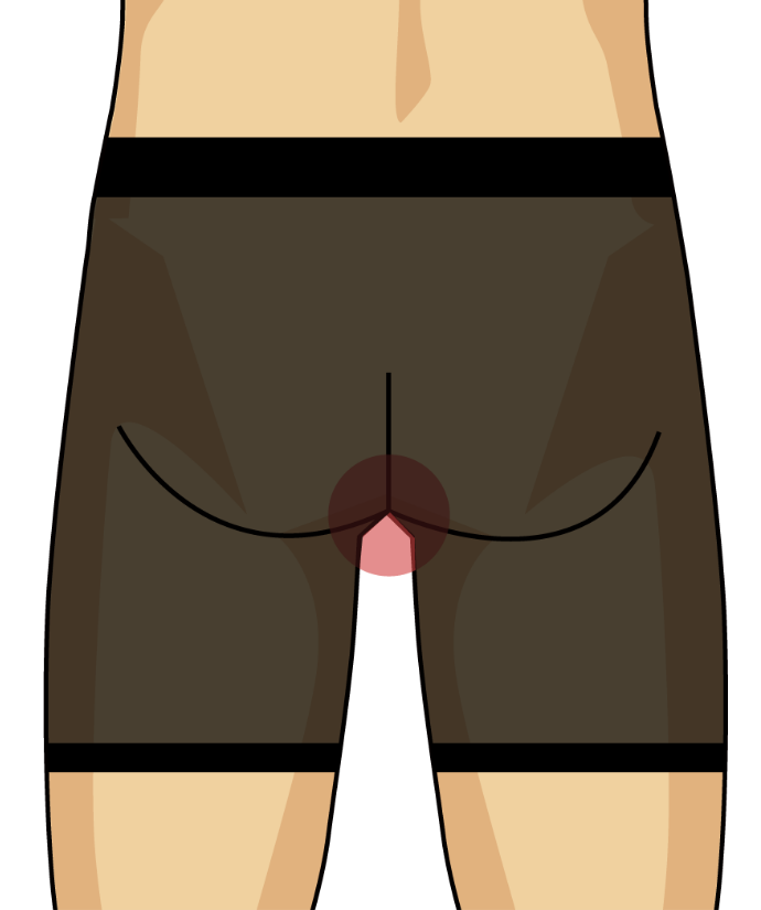 イラスト：Oライン脱毛