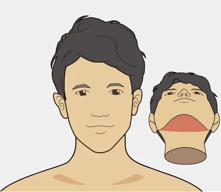 アゴ下