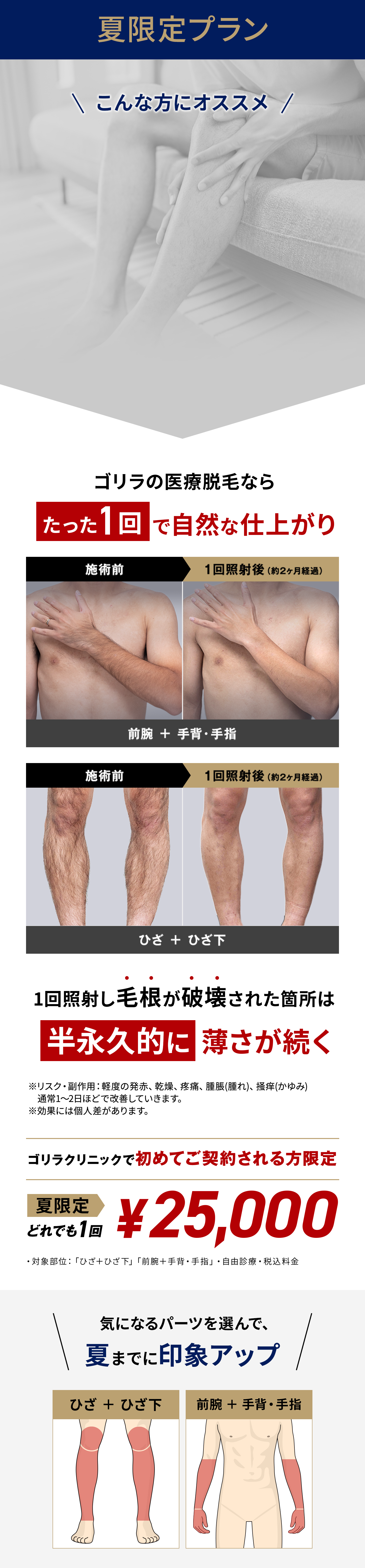 夏限定プラン