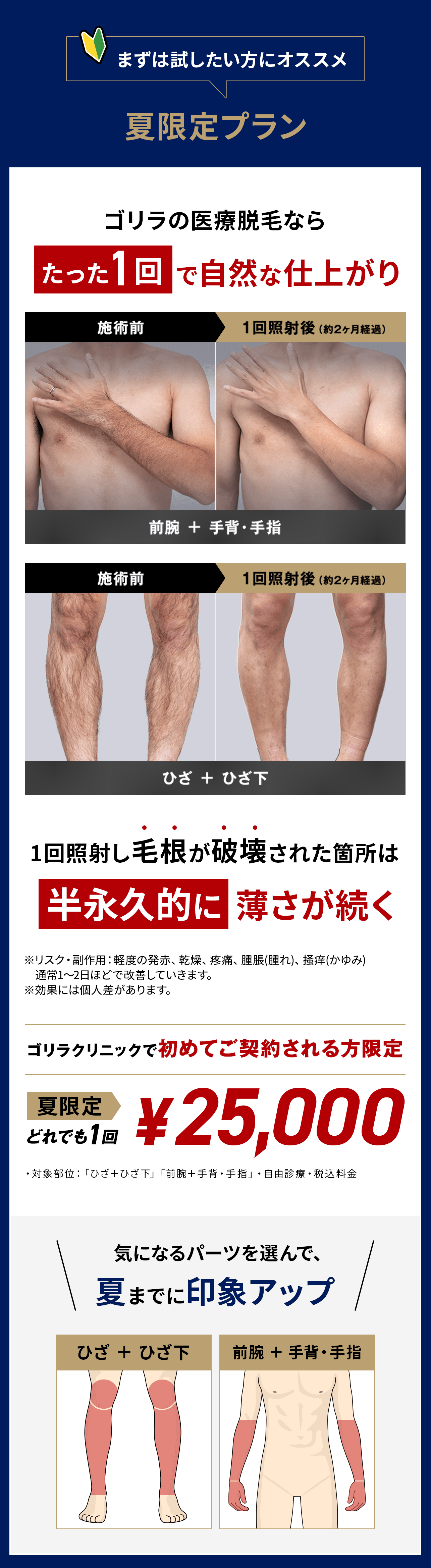 まずは試したい方にオススメ夏限定プラン