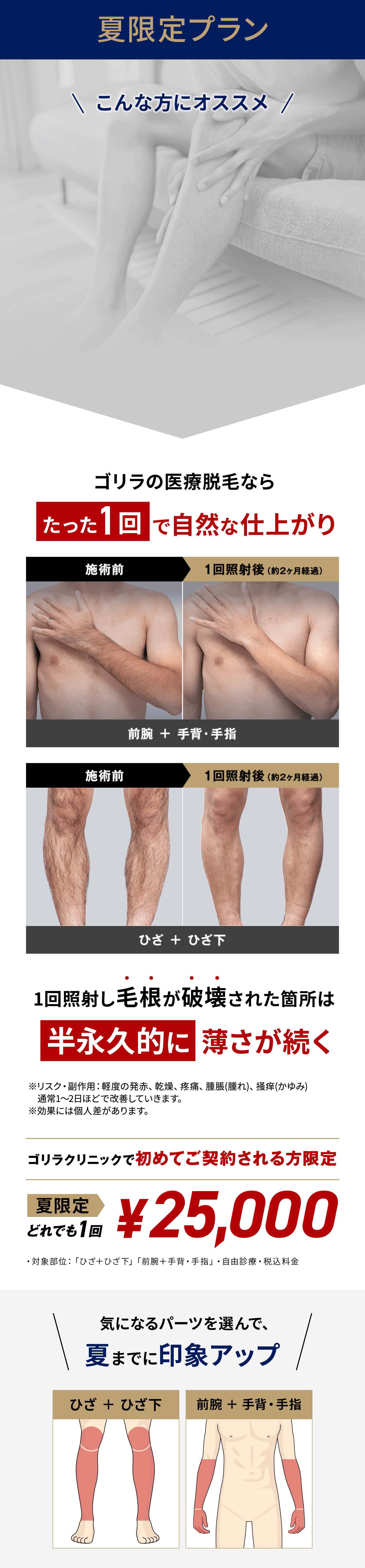 夏限定プラン