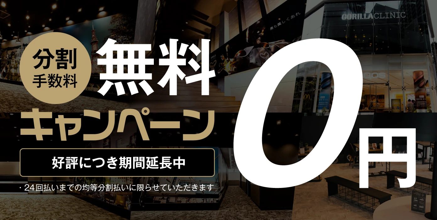 分割手数料無料キャンペーン