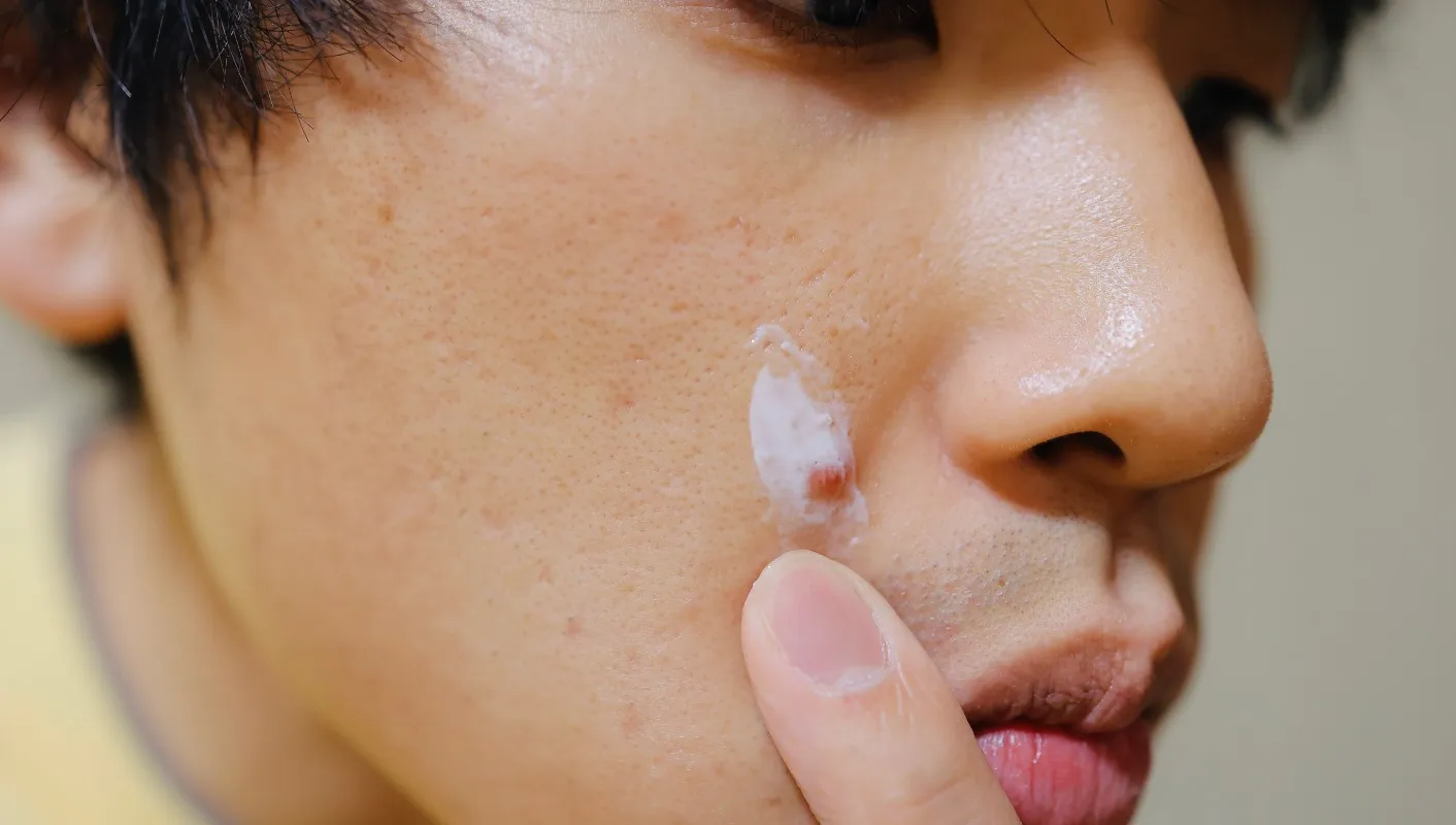 とにかく肌を綺麗にしたい