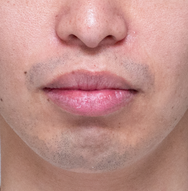 ヒゲ剃り時間「10分」深剃りしても青い