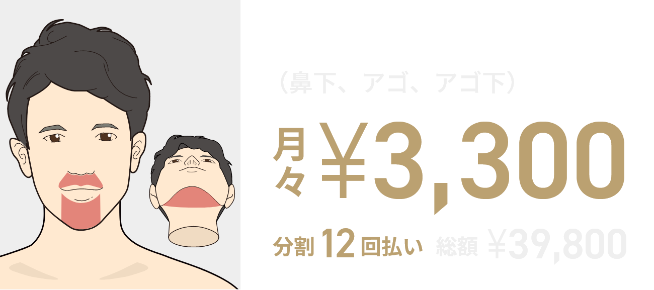ヒゲ脱毛3部位6回月々¥3,300