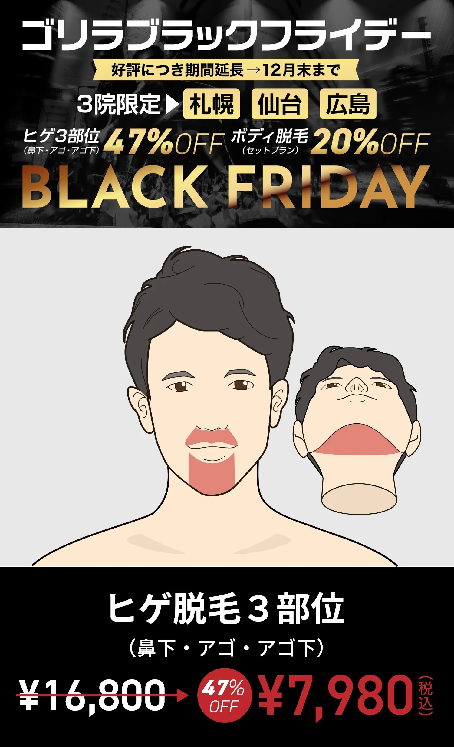 11月限定 札幌・仙台・広島 限定 ヒゲ脱毛（鼻下・アゴ・アゴ下）7,980円（税込）