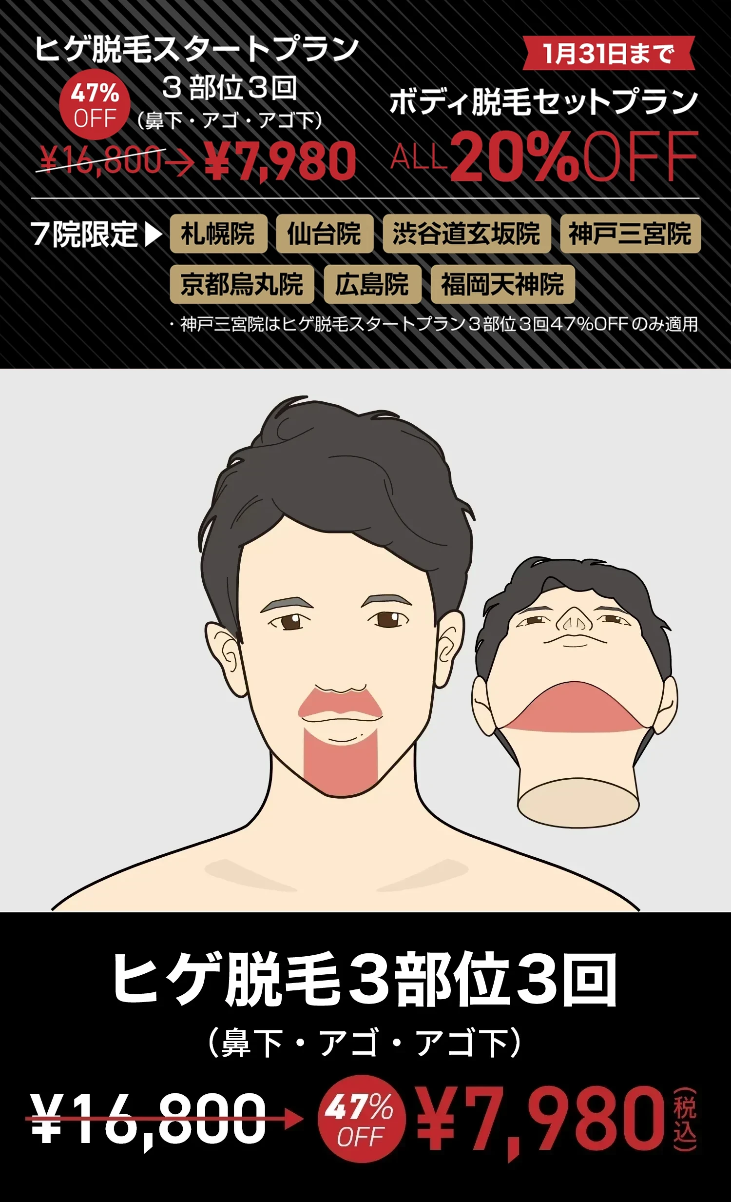 セレクトクリニックキャンペーン