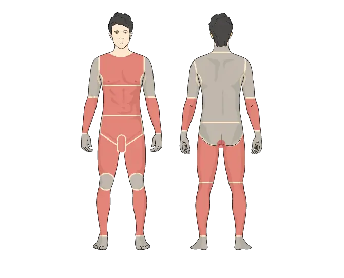 セレクト全身脱毛８部位