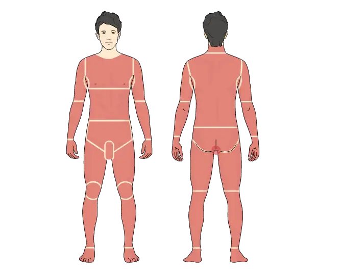 全身脱毛VIOあり