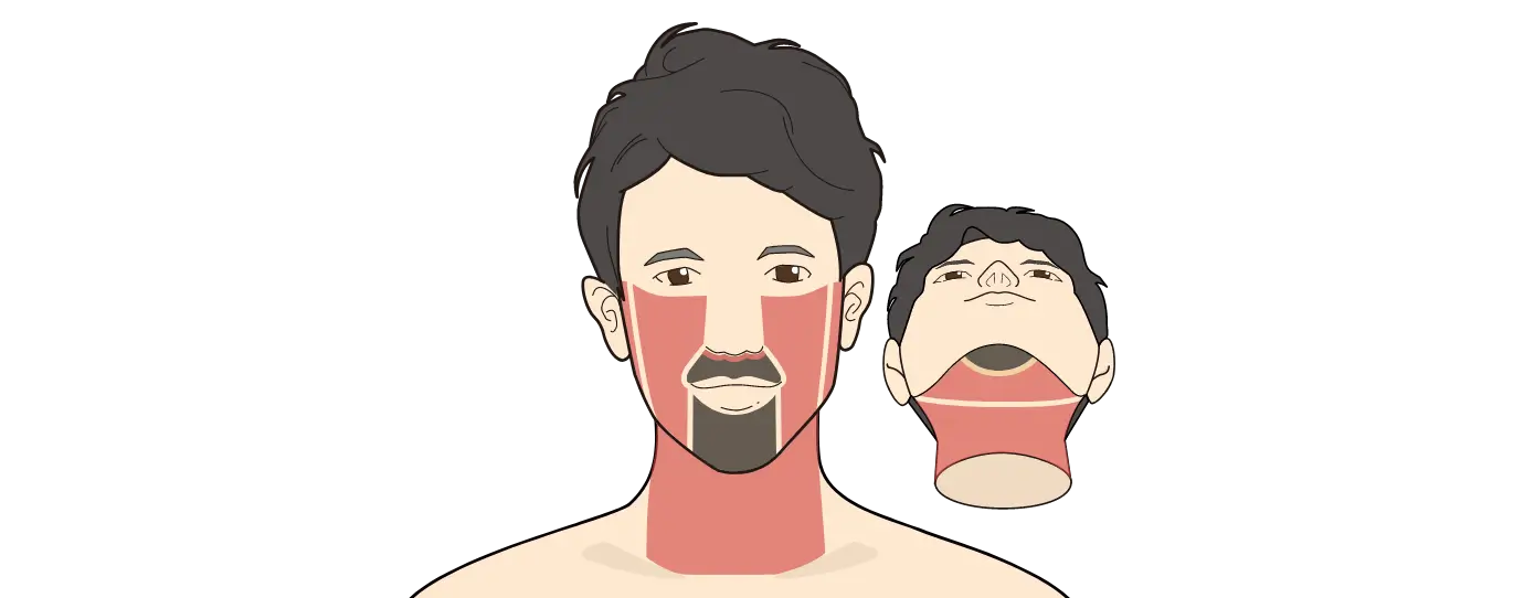 ヒゲ脱毛セレクト