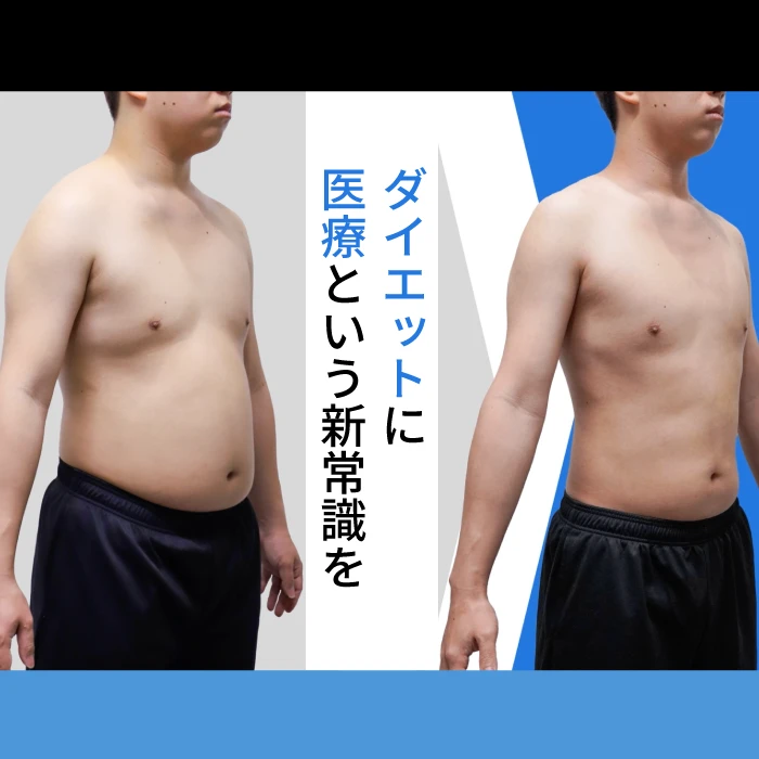 メディカルダイエット