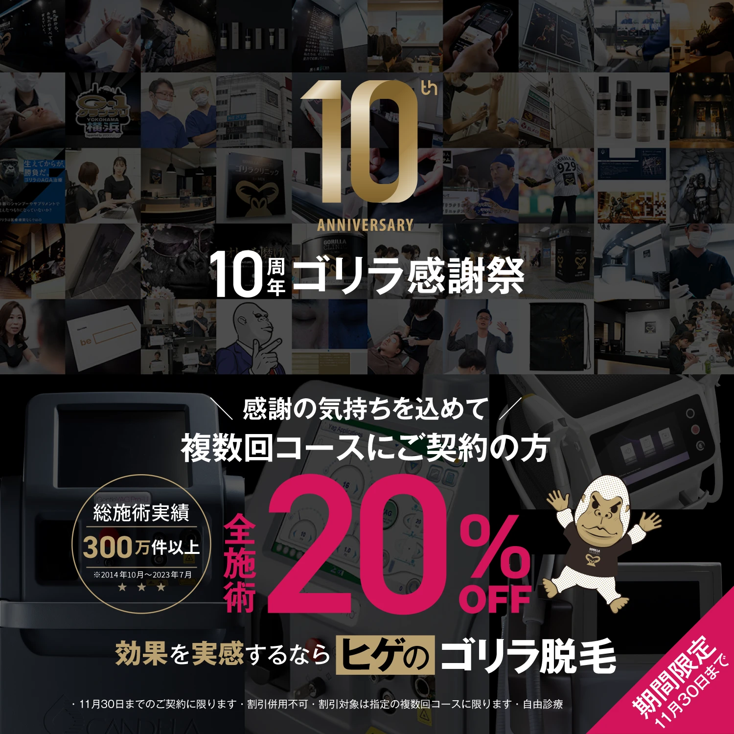 ゴリラ脱毛 10周年 脱毛キャンペーン