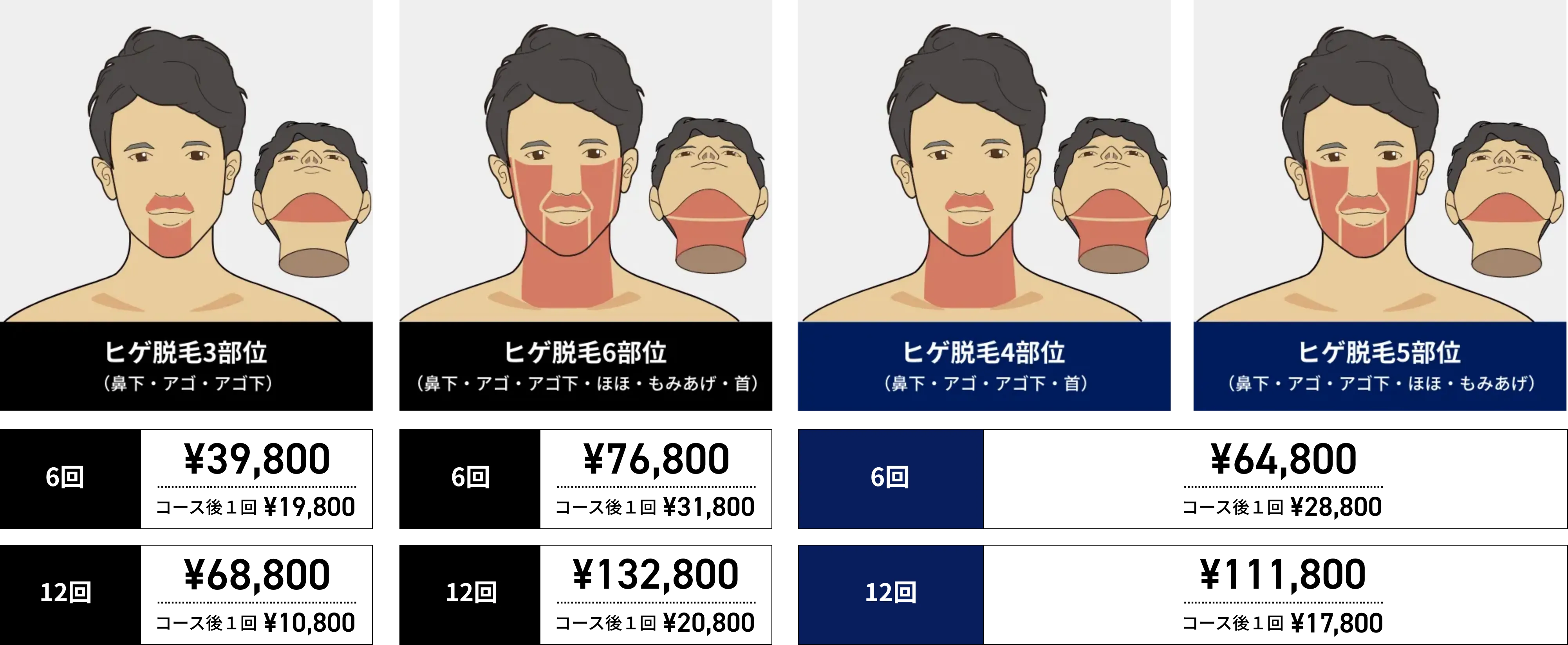 脱毛料金が今だけお得に