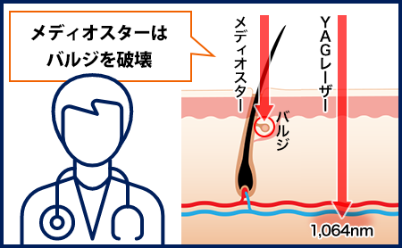 こんな方におすすめ!痛いのが苦手