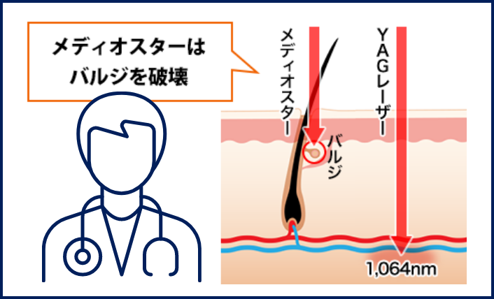 こんな方におすすめ!痛いのが苦手