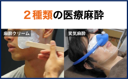 笑気麻酔と表面麻酔の2種類の医療麻酔をご提供