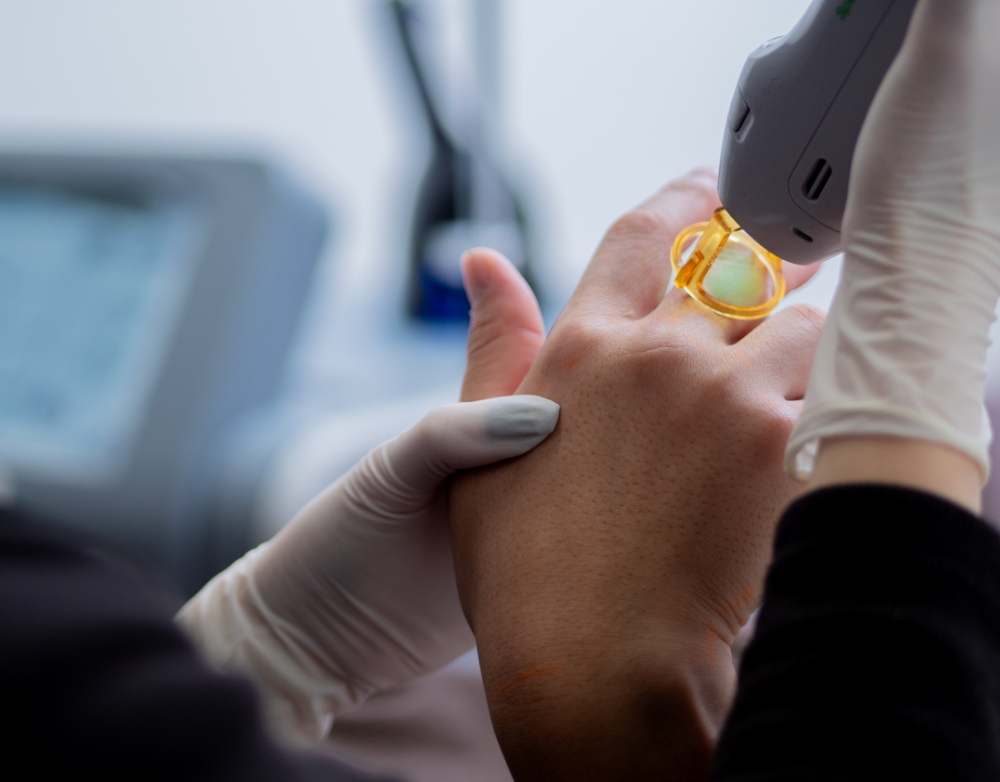 身だしなみ脱毛はどれくらい痛い？