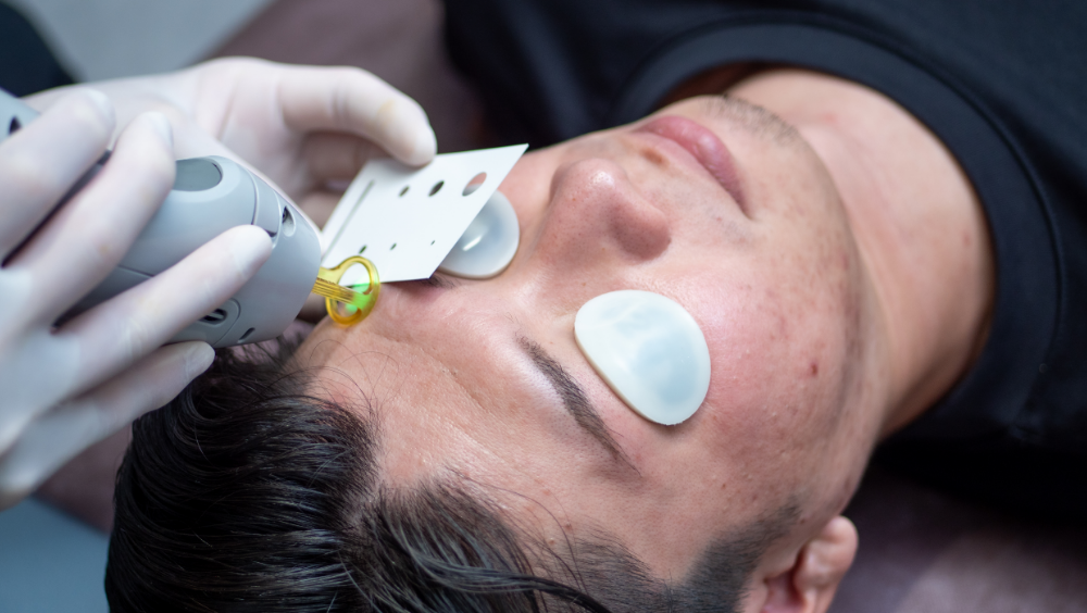 「整える」ことを前提にした医療脱毛