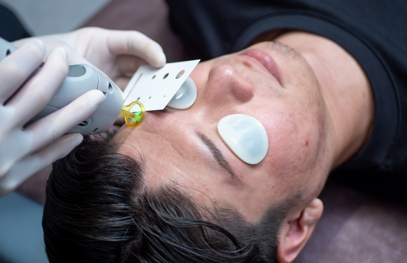 「整える」ことを前提にした医療脱毛