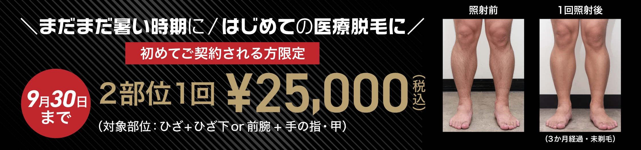 気になる今こそはじめ時　初めてご契約される方限定 身だしなみ特別プラン 9月30日まで