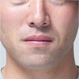 部位イメージ画像