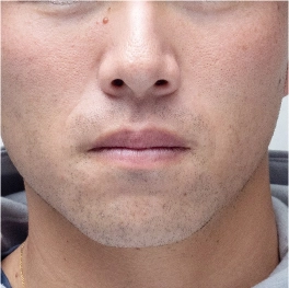 部位イメージ画像