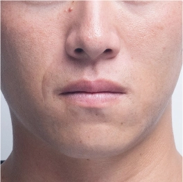 部位イメージ画像