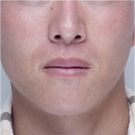 部位イメージ画像