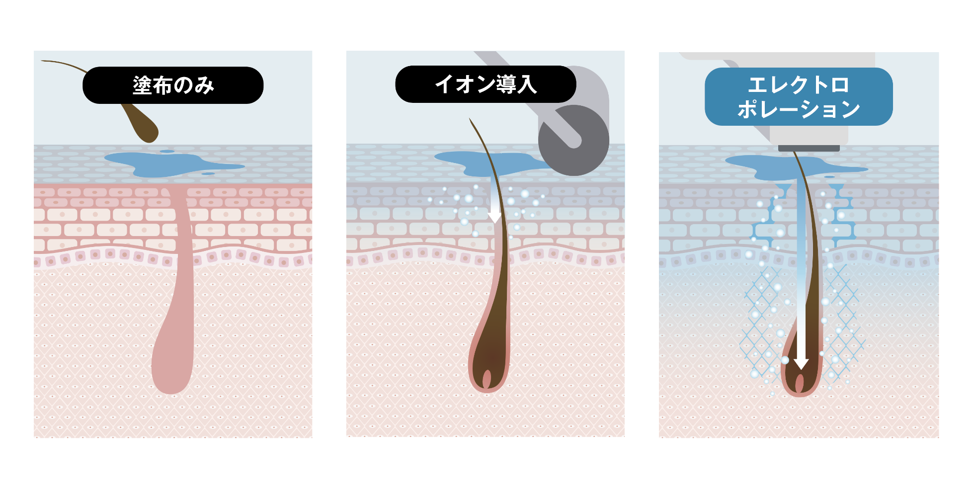エレクトロポレーション
