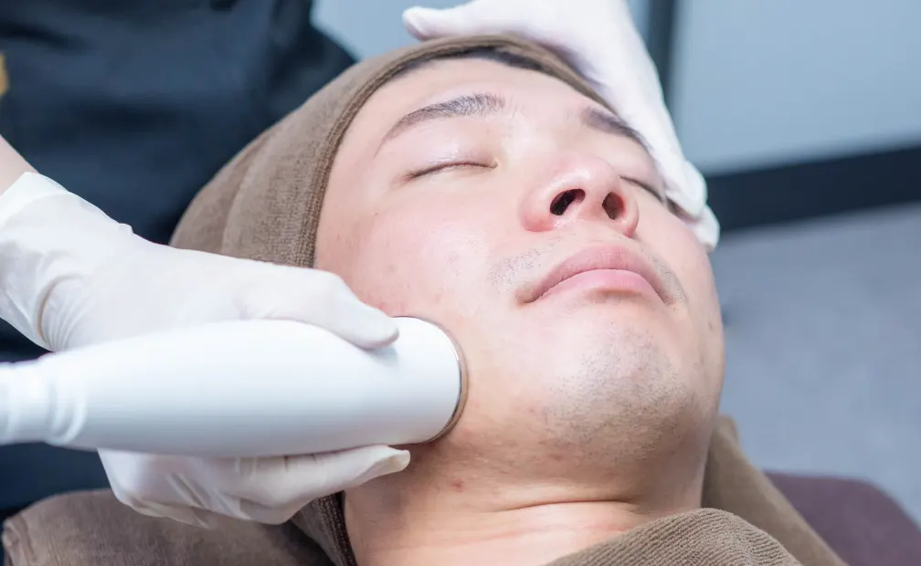 エレクトロポレーション