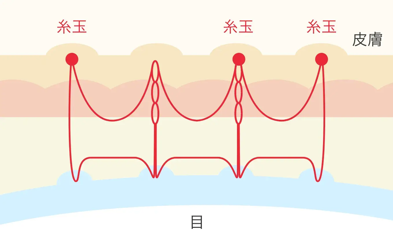 図