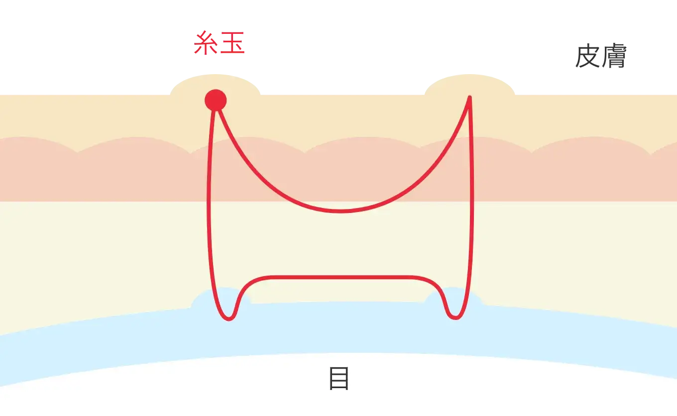 図