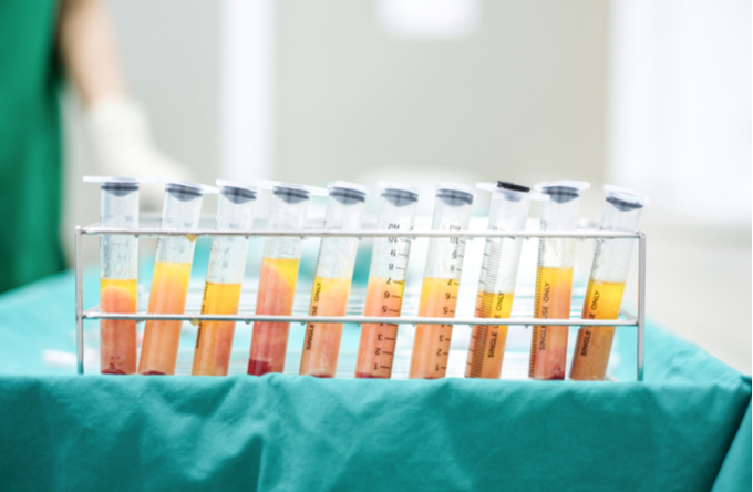 1042573b43543aefae3c7baa3572a88a