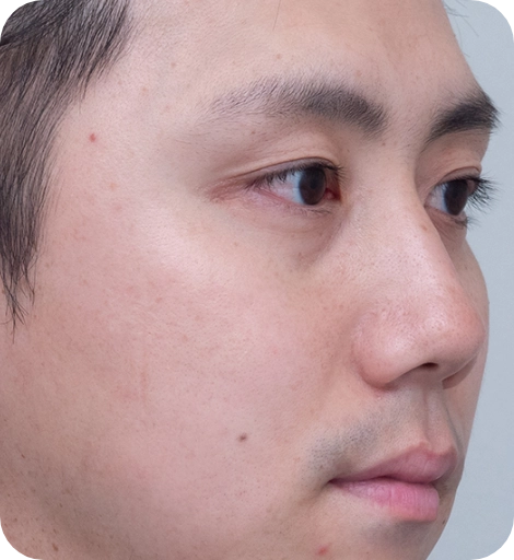 ポテンツァ After