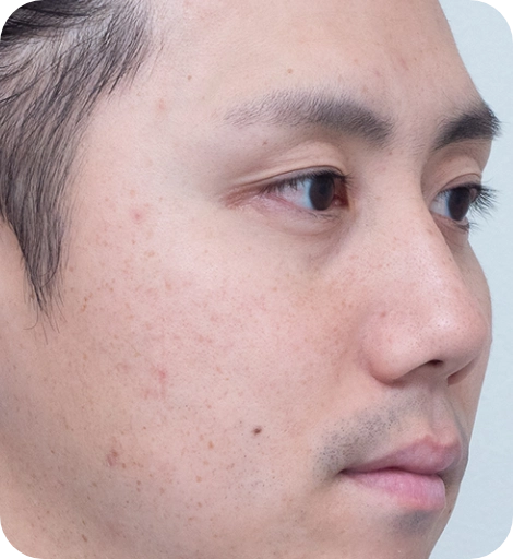 ポテンツァ Before