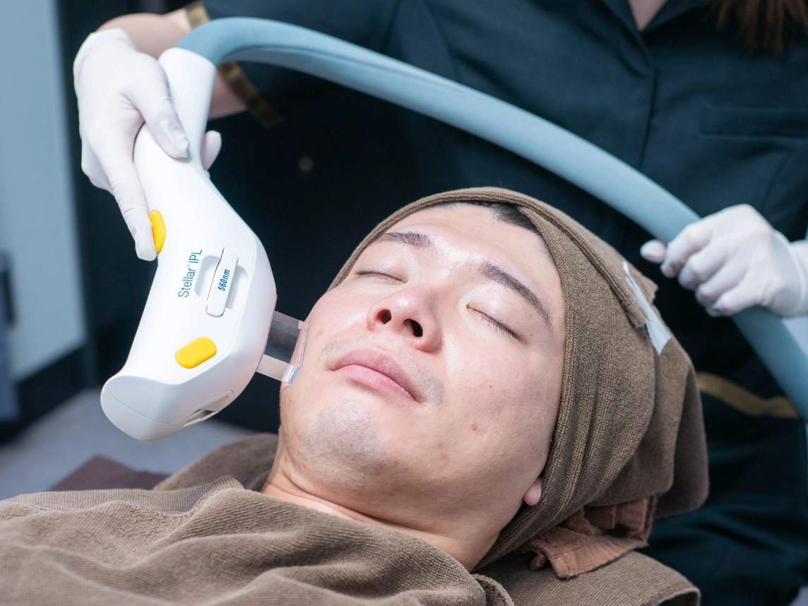 ゴリラシミ治療（ステラM22）