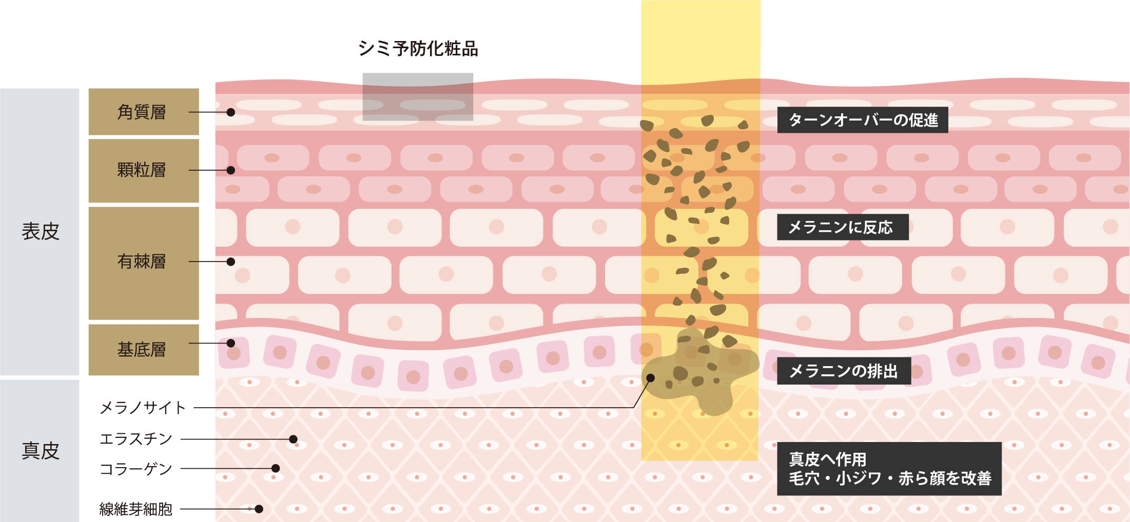 シミ予防化粧品とゴリラシミ治療（ステラM22）の違い