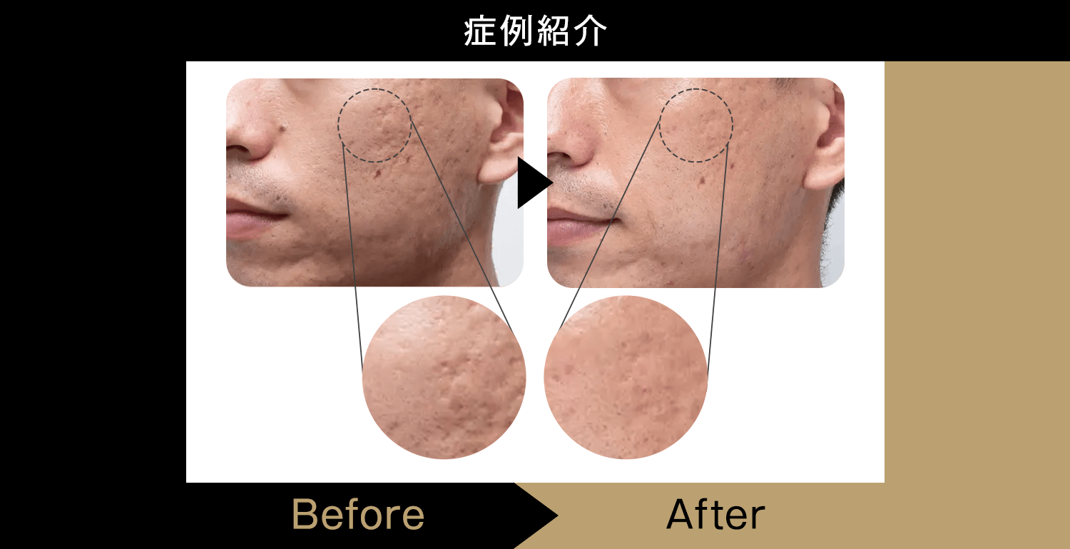 症例紹介