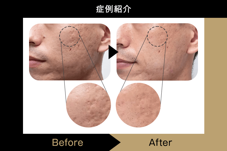 症例紹介