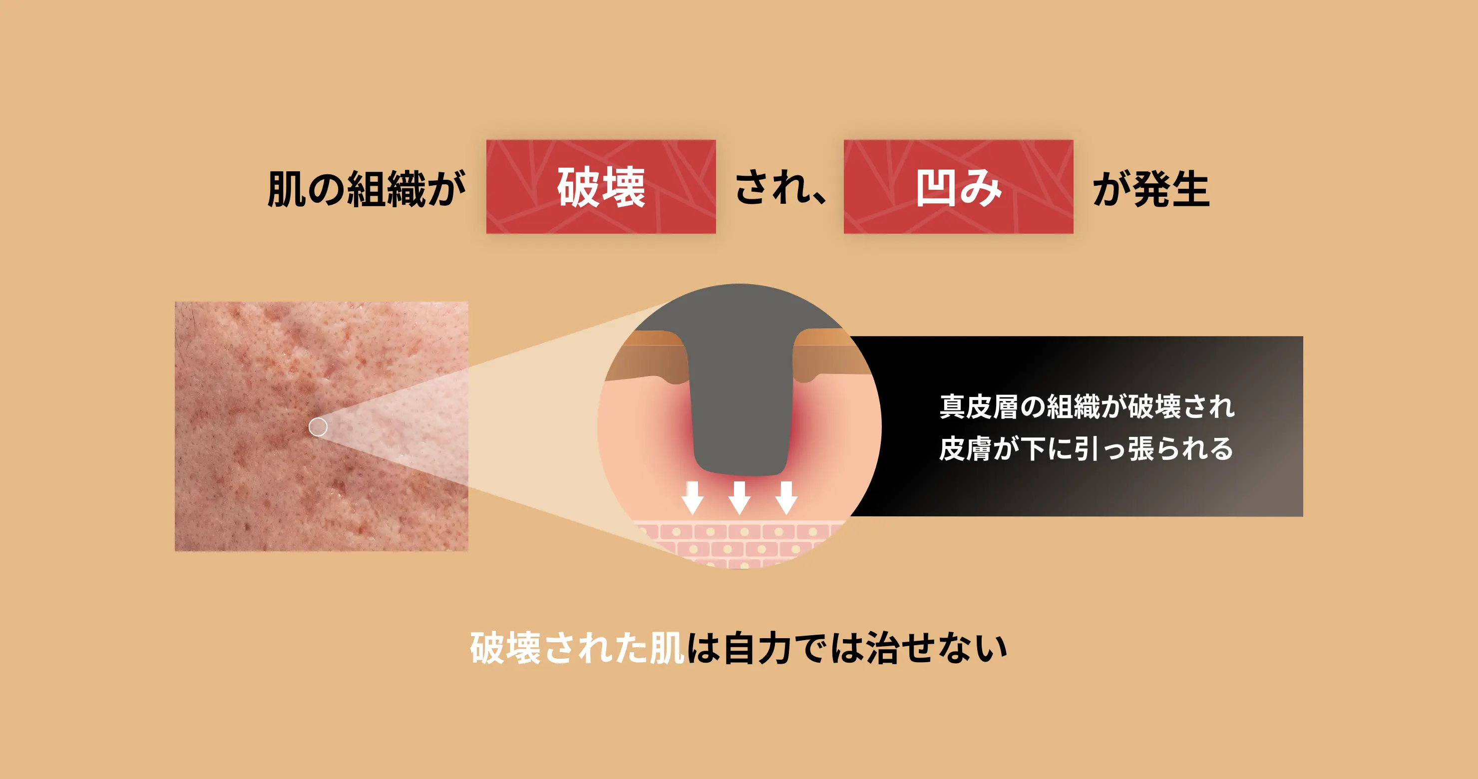 結果