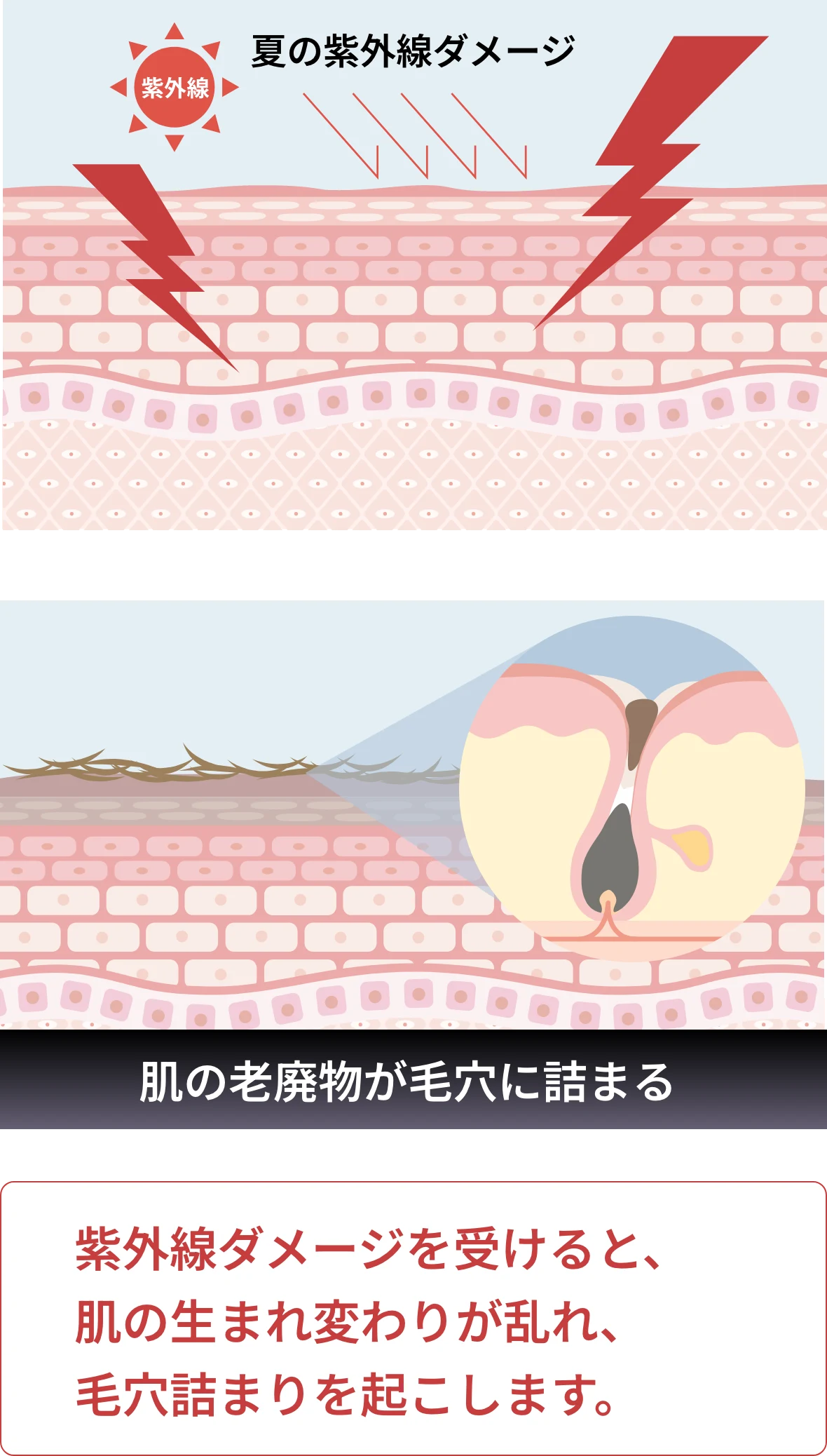 ダーマペン