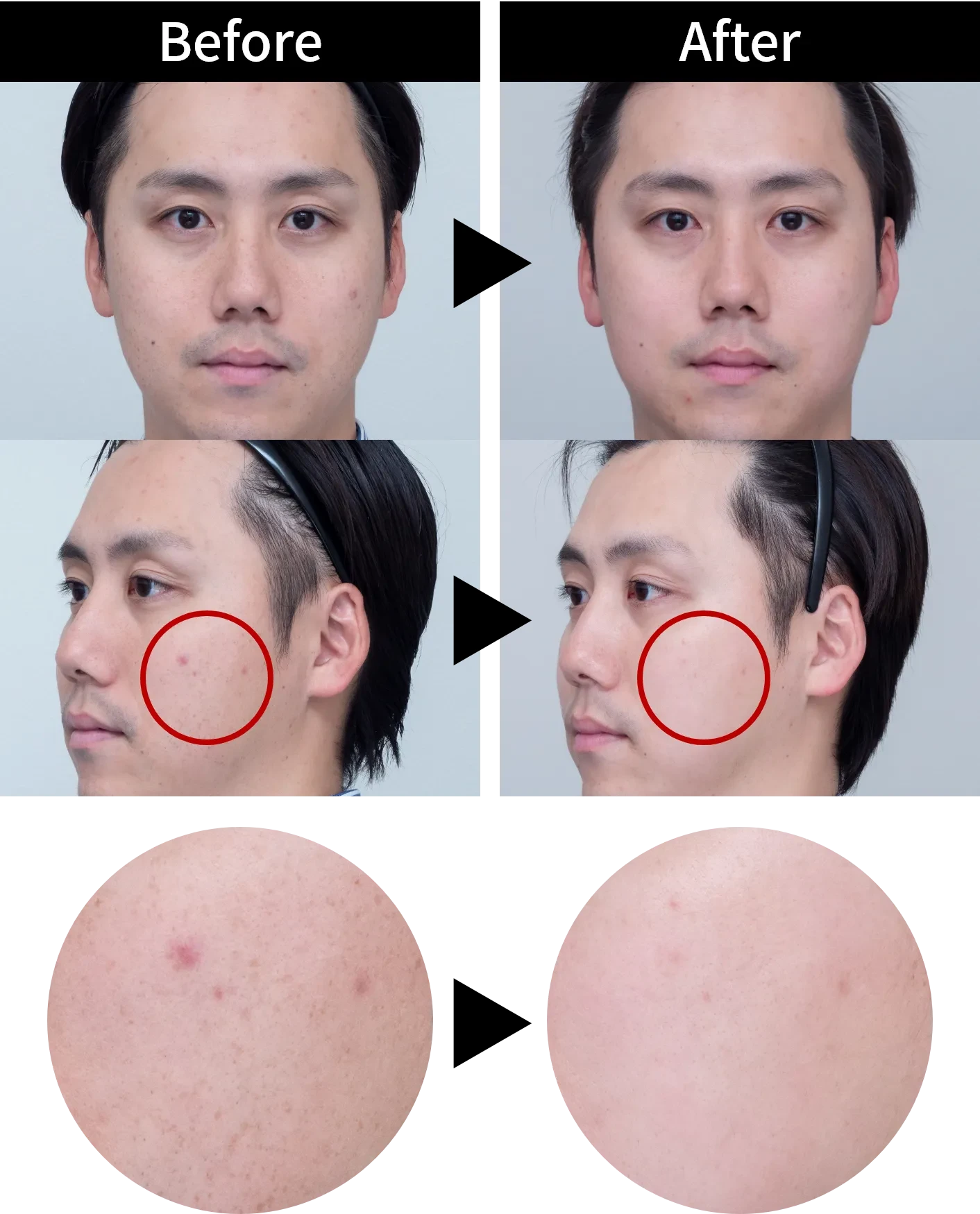 ビフォーアフター