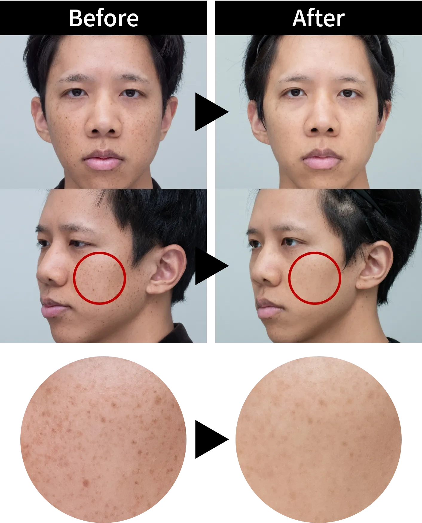 ビフォーアフター